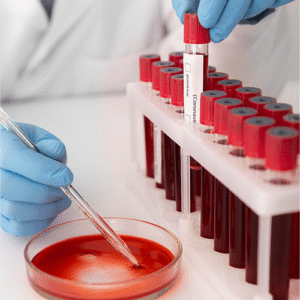 Hemoglobina Glicada (HbA1c)